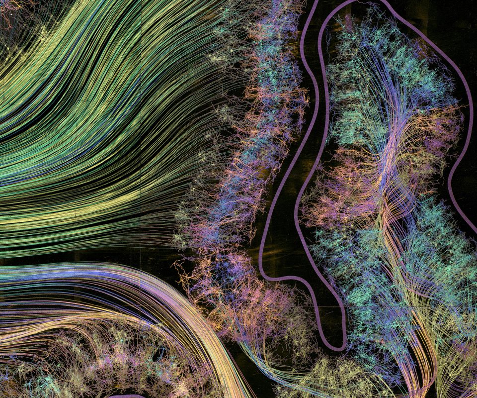 Secondary Visual Cortex Greg Dunn