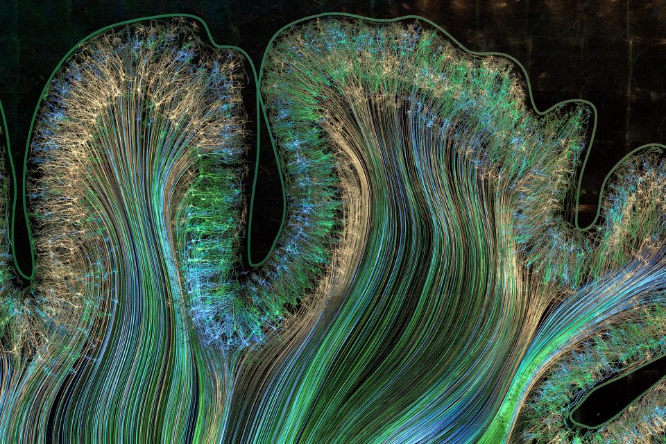 Motor and Parietal Cortex Greg Dunn